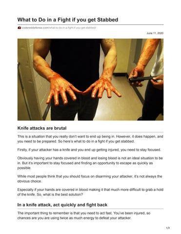 Just follow these steps and you could save someone&39;s life . . What to do if you get stabbed by a knife